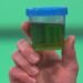 Green Urine Causes, Concerns, and When to Seek Medical Attention