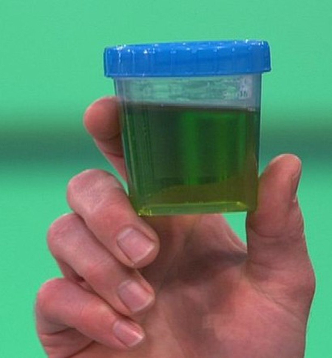 Green Urine Causes, Concerns, and When to Seek Medical Attention