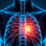 Heart Attack Symptoms